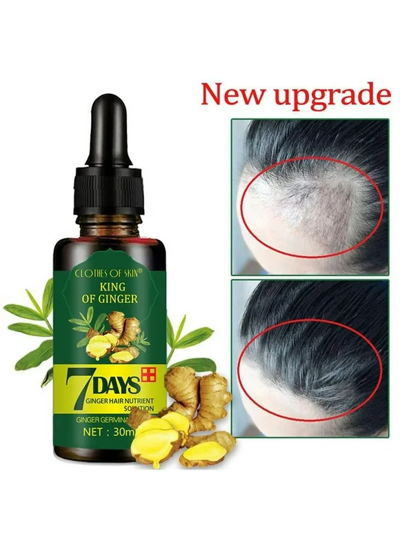 JANDEL 1 Pack Ginger Germinal Oil,2021 Hair Growth Ginger Essential Oil Hair Growth Oil Hair Loss Treatment For Women and Men