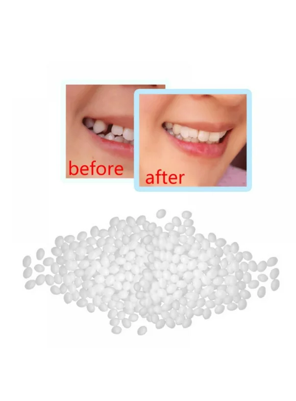 Temporary Tooth Repair DIY Kit Snap On Instant Natural Smile Replace Missing and Broken Tooth Gap Eliminator Healthy Smiles 5G